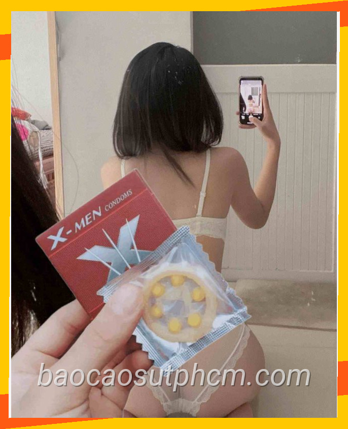 Bao cao su bi xmen 940
